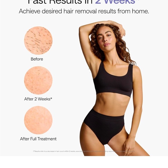 Ulike Laser Hair Removal, Air 10 IPL Hair Removal for Women and Men (New in Box) - Picture 2 of 4